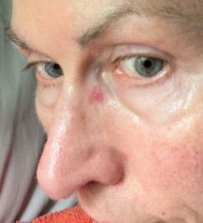 Skin and the People Inside